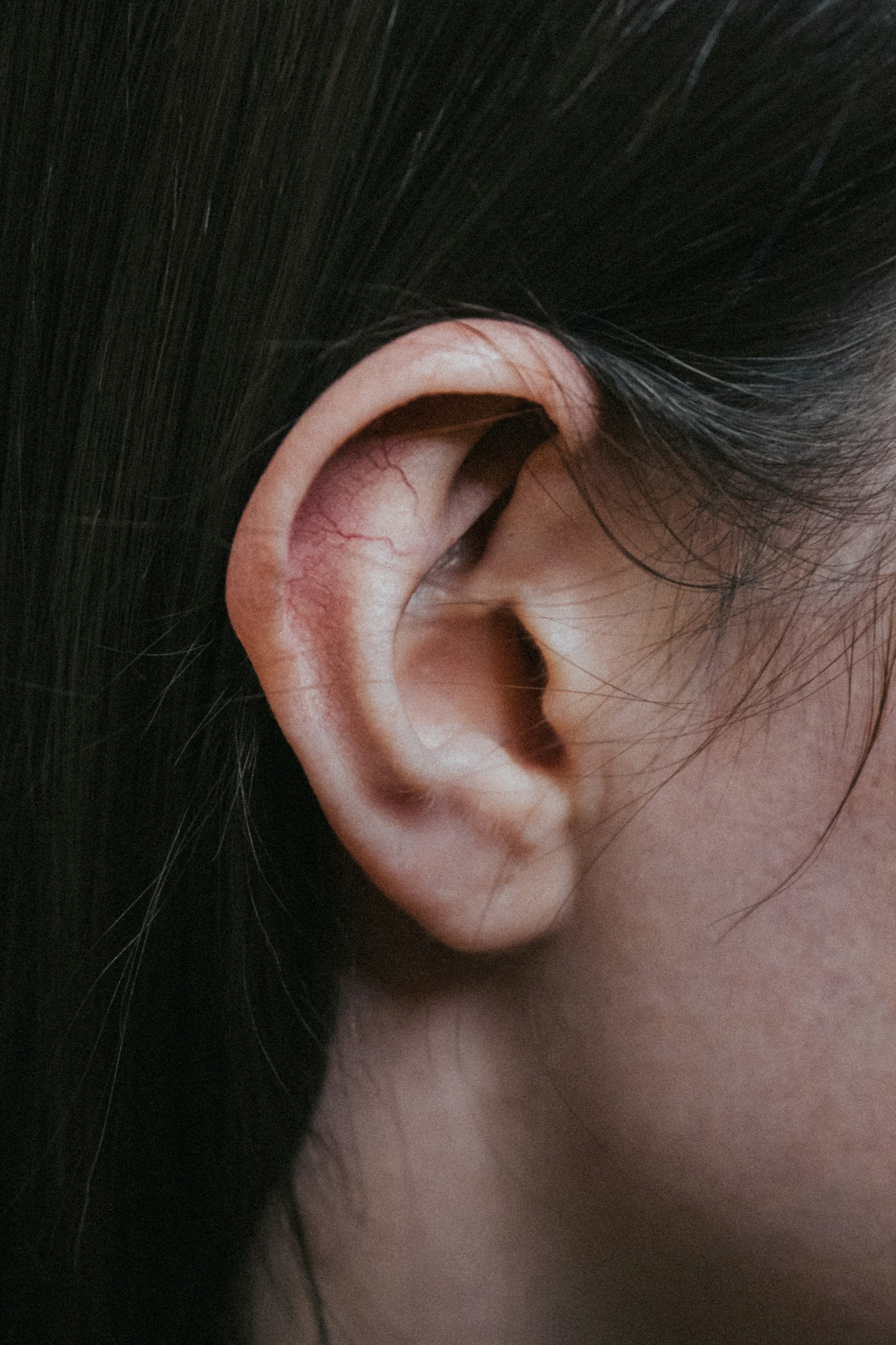 Detalhe de auriculoterapia com sementes aplicadas na orelha
